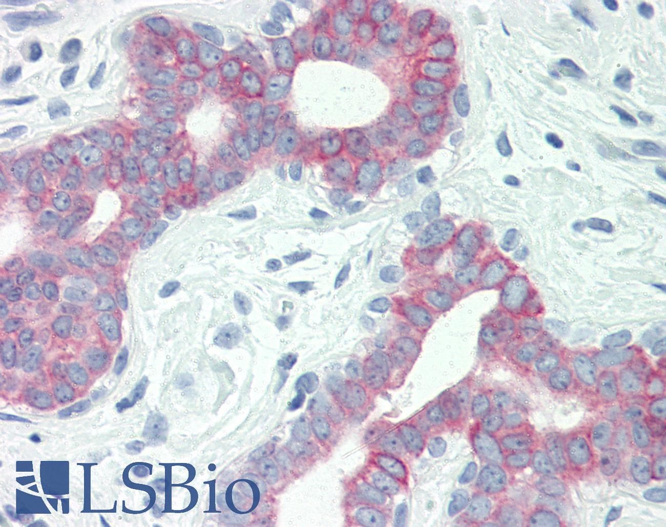 KRT19 / CK19 / Cytokeratin 19 Antibody (DY488)