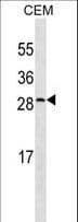 CRP / C-Reactive Protein Antibody (aa194-221)
