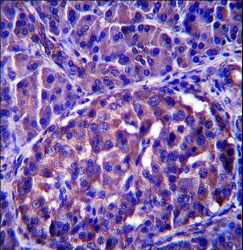 LRRN4 / C20orf75 Antibody (aa557-586)