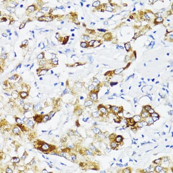 FN1 / Fibronectin Antibody
