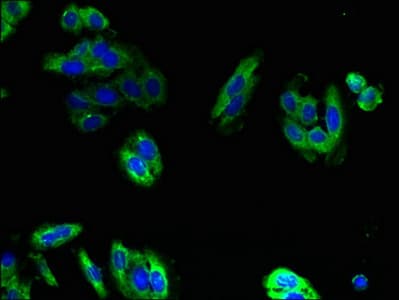 Polyclonal Rabbit anti-Human PIGS Antibody