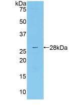 MASP2 / MASP-2 Antibody (aa445-683)
