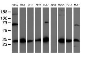 IHC-plus™ CBR3 Antibody (clone 1G6)
