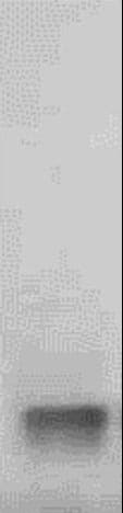 IHC-plus™ ALDOA / Aldolase A Antibody (Lyophilized)