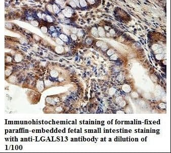 Polyclonal Rabbit anti-Human LGALS13 / Galectin 13 Antibody (aa15-114, IHC, WB)
