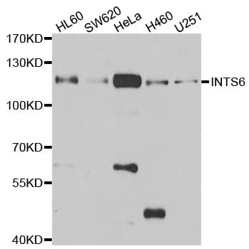 INTS6 Antibody
