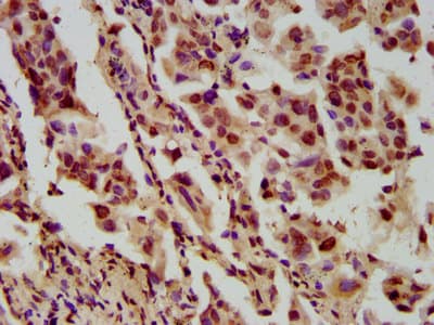 Polyclonal Rabbit anti-Human HIST1H4I Antibody (IHC)
