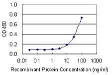 Monoclonal Mouse anti-Human NOS3 / eNOS Antibody (clone 1D12, WB)