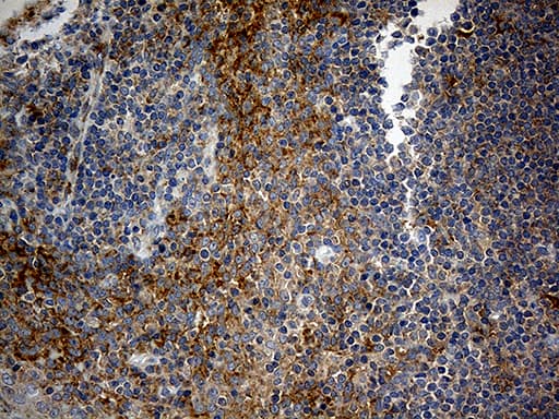 RPL7A / Ribosomal Protein L7a Antibody (aa2-266, clone OTI3C5, Carrier-free)