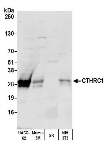 CTHRC1 Antibody (aa193-243)