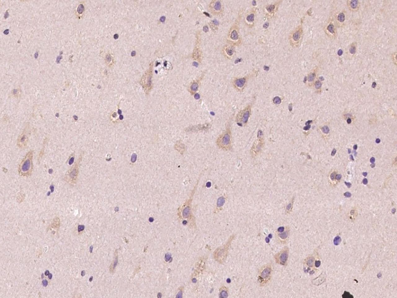 NEDD4 Antibody