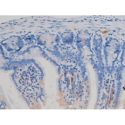 NOS3 / eNOS Antibody (phospho-Ser1177)