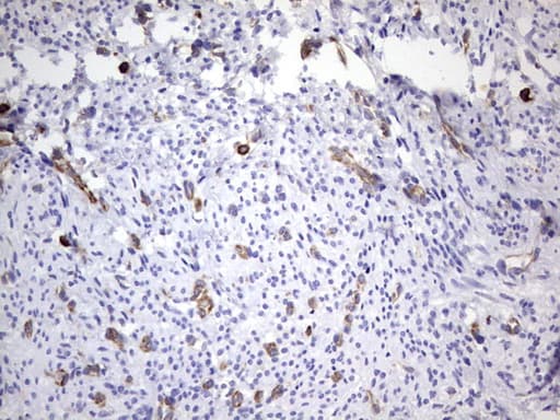 PPP2R5D Antibody (clone OTI3B3)