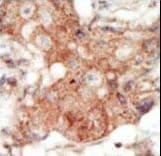 Polyclonal Rabbit anti-Human EPHA4 / EPH Receptor A4 Antibody (aa875-904, IHC, WB)