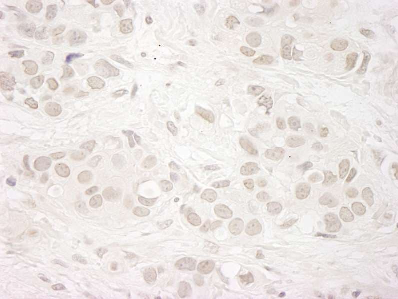 Polyclonal Rabbit anti-Human KDM5A / JARID1A Antibody (aa1640-1690, IHC)