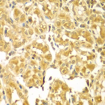 SESN2 / HI95 Antibody