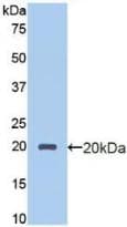 PROCR / EPCR Antibody (aa63-205)