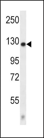Polyclonal Rabbit anti-Human CACNA2D2 Antibody (aa643-671, IHC, IF, WB)
