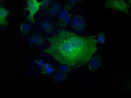 PFN1 / Profilin 1 Antibody (clone OTI2D2, Carrier-free)