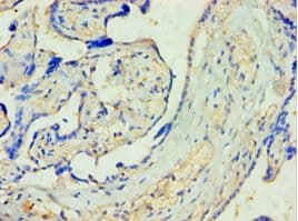Polyclonal Rabbit anti-Human M-PST / STM Antibody (aa1-295, IHC, WB)