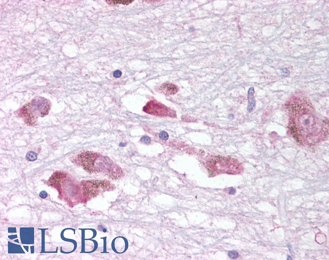 IHC-plus™ MCHR1 Antibody (C-Terminus)