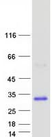 Human RAB33A Protein (Recombinant Myc-DDK (Flag))