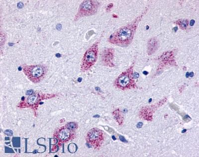 PathPlus™ Polyclonal Rabbit anti-Human ADGRE3 / EMR3 Antibody (N-Terminus, IHC)