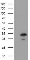 CTDSP1 / SCP1 Antibody (clone OTI1G1)