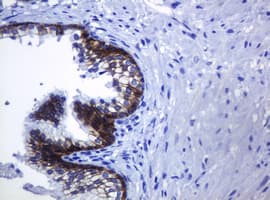 CDH1 / E Cadherin Antibody (clone OTI4F1)