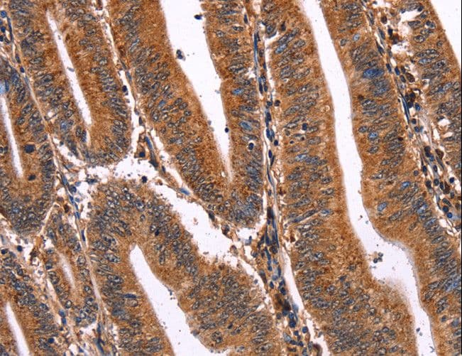 ELP2 / STATIP1 Antibody