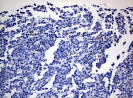 ZEB2 / SIP-1 Antibody (clone OTI15G8)
