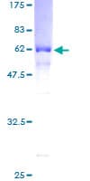 Human FLCN / Folliculin Protein (Recombinant GST)