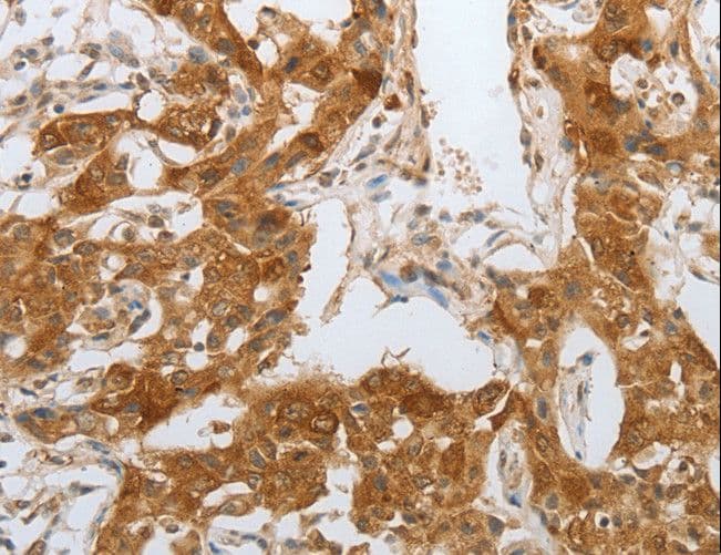 NPY1R Antibody