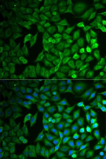Polyclonal Rabbit anti-Human FBXO11 Antibody (IF, WB)