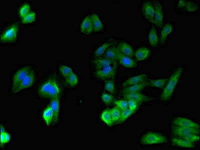 SPPL3 / IMP2 Antibody