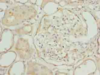 EPM2AIP1 Antibody