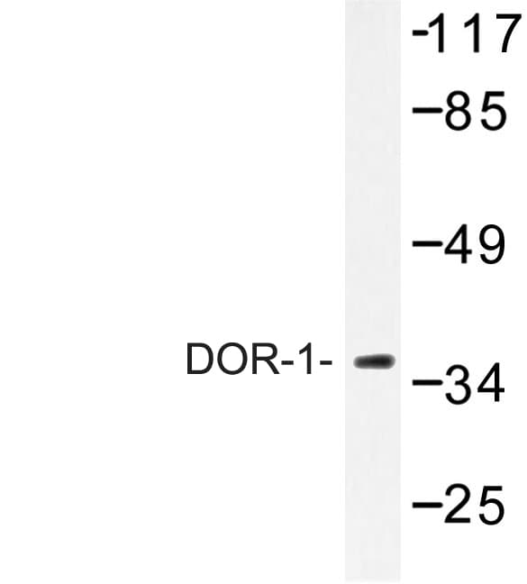 OPRD1 / Delta Opioid Receptor Antibody (Phe345)