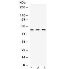 Polyclonal Rabbit anti-Human FGB / Fibrinogen Beta Chain Antibody (WB)