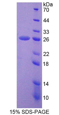 Human PSMD5 Protein (Recombinant His-T7)