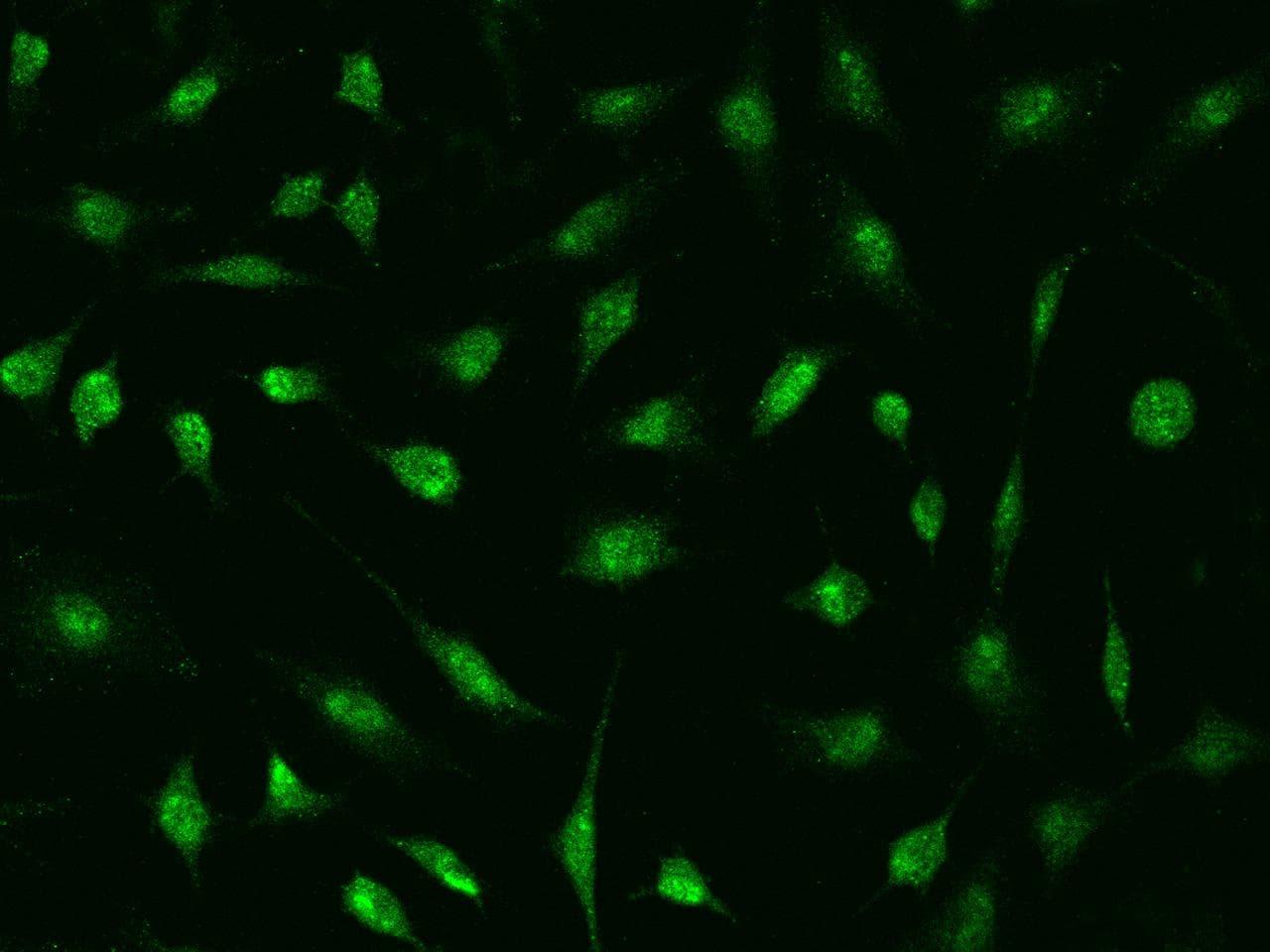 DDX56 Antibody