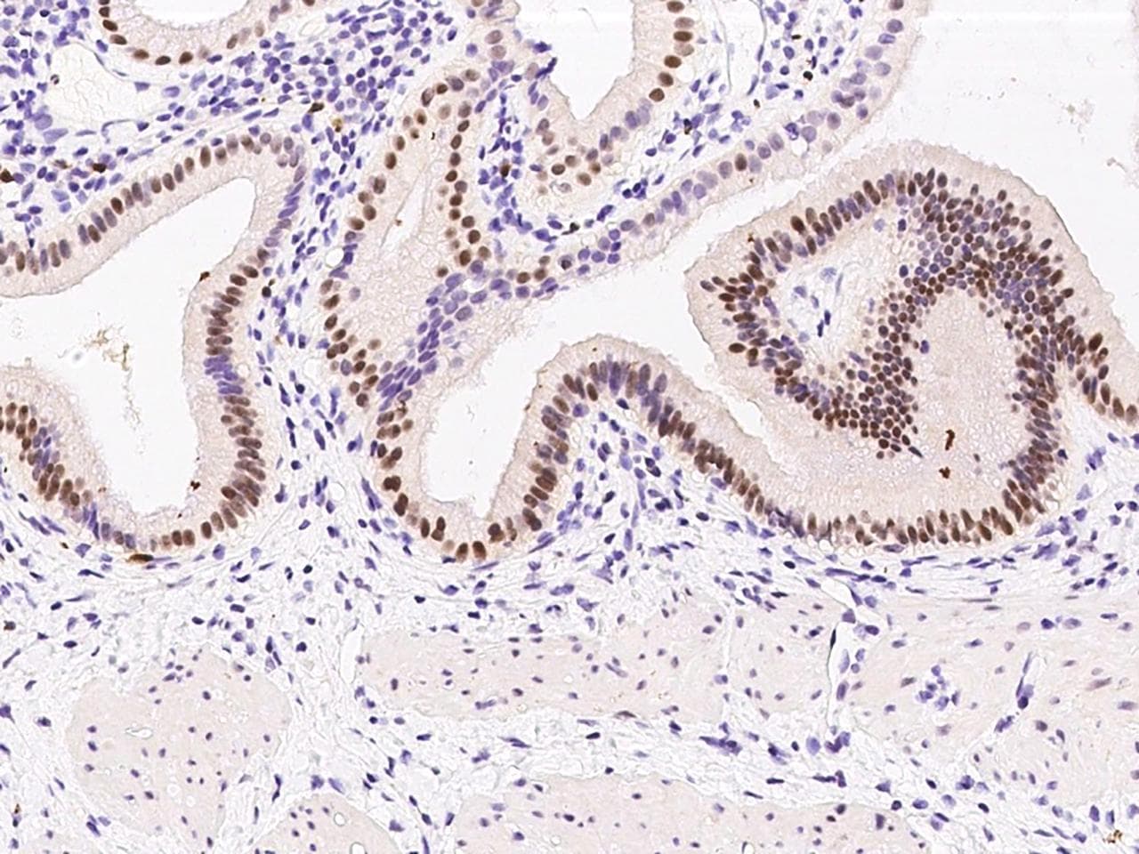 PRPK / TP53RK Antibody (Preservative Free)
