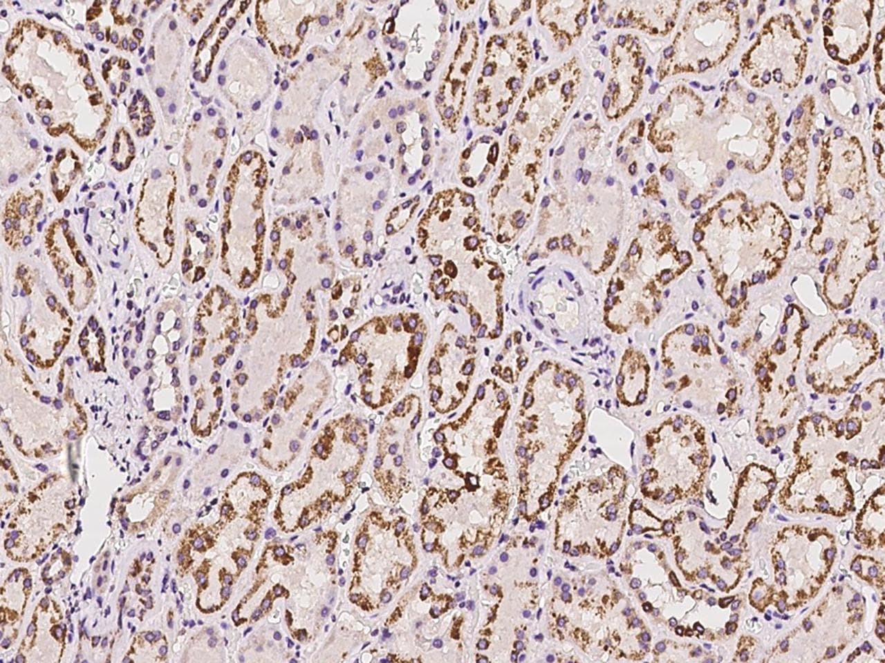Polyclonal Rabbit anti-Human ACADL Antibody (IHC)
