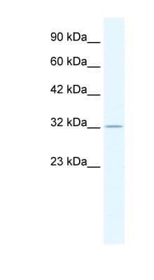 Polyclonal Rabbit anti-Human ZFP36 / Tristetraprolin Antibody (aa84-133, IHC, WB)