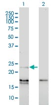EDN1 / Endothelin 1 Antibody (clone 3D6)