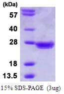 Human MAD2L1 / MAD2 Protein (Recombinant His)