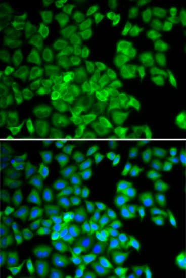 TCP1 Antibody