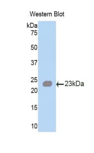 ANGPTL2 / ARP2 Antibody (aa141-308)