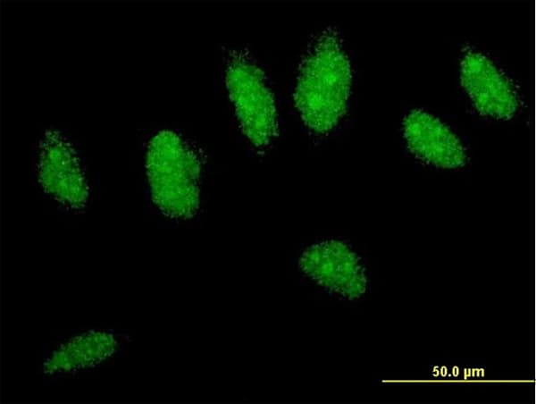 CYLD Antibody (clone 2C3)