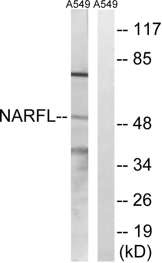 IOP1 / NARFL Antibody (aa387-436)