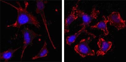ACTB / Beta Actin Antibody (N-Terminus, clone 8H10D10)